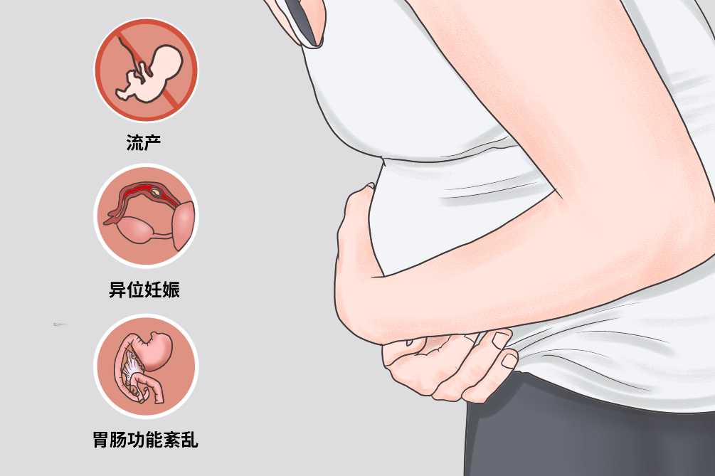 杭州代孕费用最便宜-广州代孕机构供卵靠谱吗？