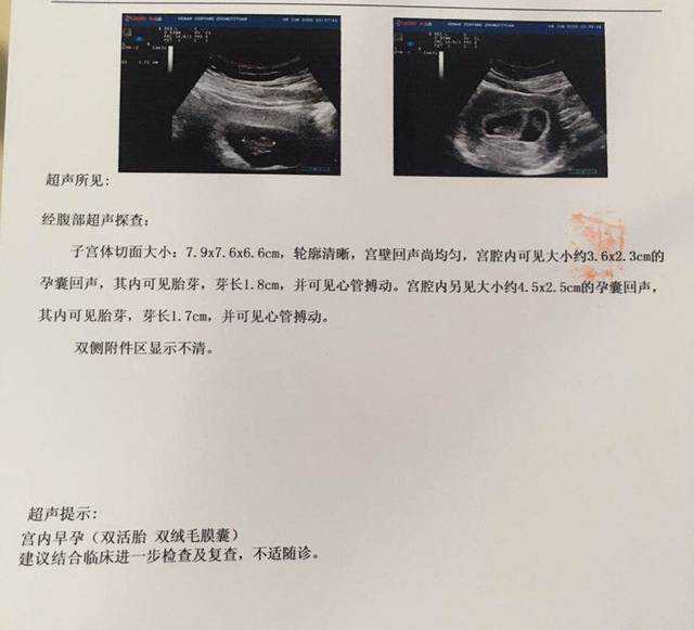 广州自愿免费捐卵，广州丰唇珠哪家医院好？